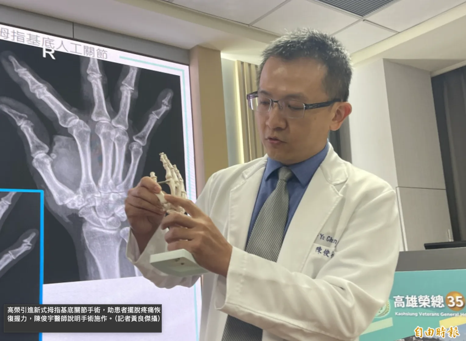 高雄榮總記者會分享拇指基底人工關節重建成果封面